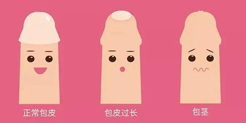 包皮过长但是可以翻出来 需要割包皮吗
