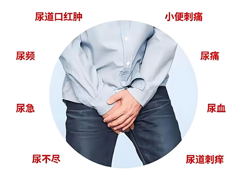 尿道炎有哪些症状，8个性尿道炎的症状