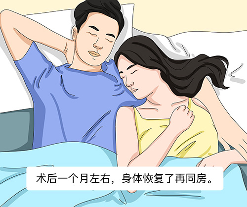 包皮手术后多久可以同房