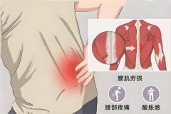 腰疼是什么原因引起的男性