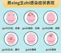男性怎么判断自己有没有性疾病