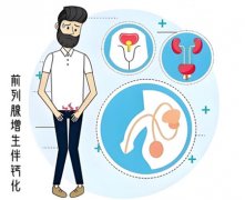 前列腺钙化是怎么回事需要治疗吗