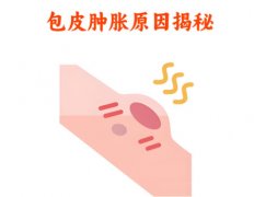 包皮水肿可以吃消炎药吗