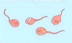 男人不育的主要原因