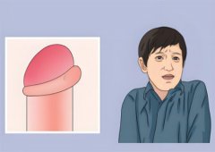 茎肿皮了肿了一圈会消吗