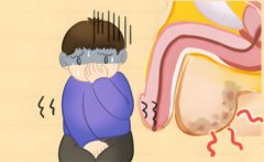 阴囊潮湿是什么原因造成的