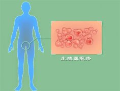 怎么样确认是生殖疱疹呢