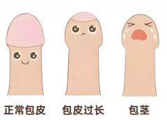包茎影响正常生活吗