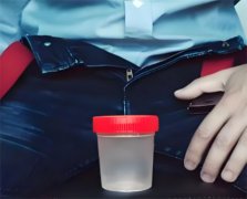 果冻精如何恢复