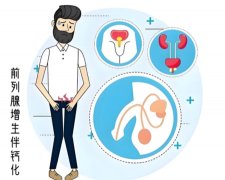 前列腺增生伴钙化是什么意思，严重不