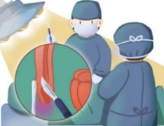 割了皮包性功能会增强吗