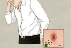 男性感染hpv有什么危害
