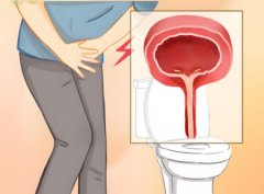 男性尿完尿后刺痛还想尿