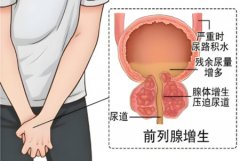 前列腺炎怎么引起的原因有哪些