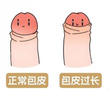 35岁男人割皮有必要割吗