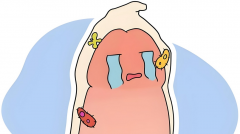 包皮上裂小口子像针刺一样疼怎么回事