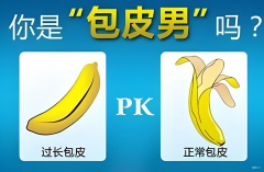 扬州包皮手术能够延长性时间吗