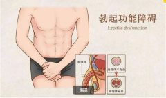 男人性能力弱怎么解决