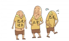 包皮过长有哪些危害