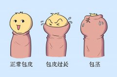 包皮过长怎么办？这几招轻松解决“小”烦恼！