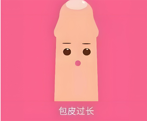 包皮太长会怎么样