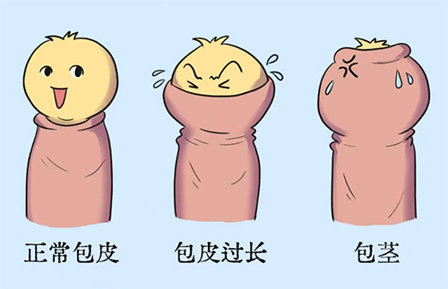 包茎什么原因造成的