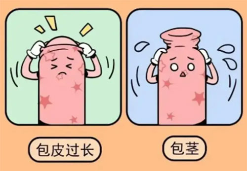 包茎什么年龄割好