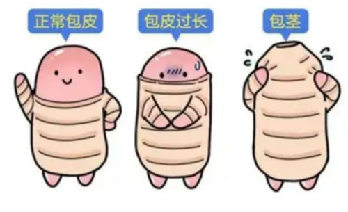 包茎什么时候会消失