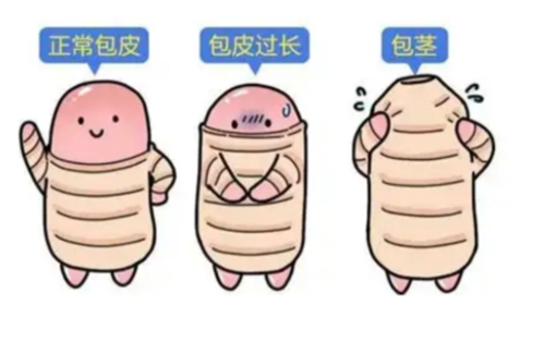 包茎什么时候可以翻开