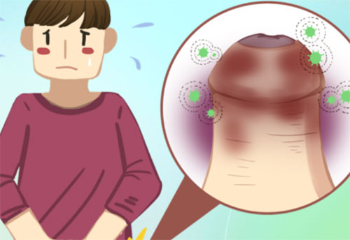 包皮红痒怎么回事