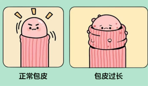 包皮太长了会怎么样