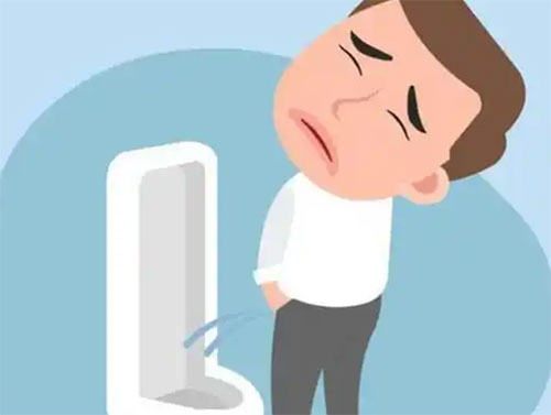 男人尿分叉是什么原因造成的
