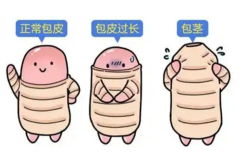 包皮太长了对女生有什么影响