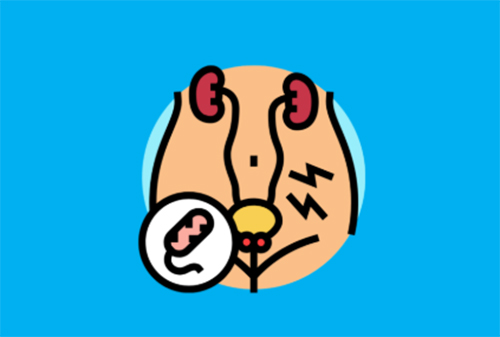 男人尿路感染怎么治疗