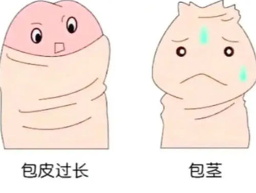 包皮太长了怎么处理