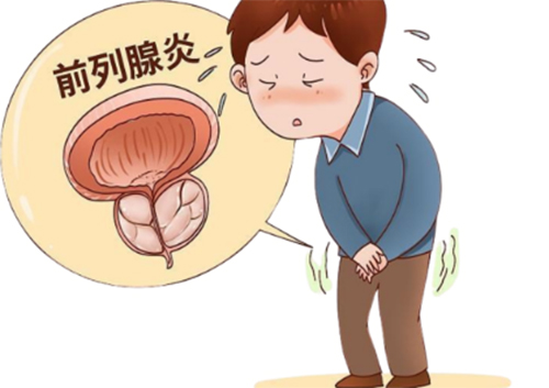 前列腺炎是怎么形成的