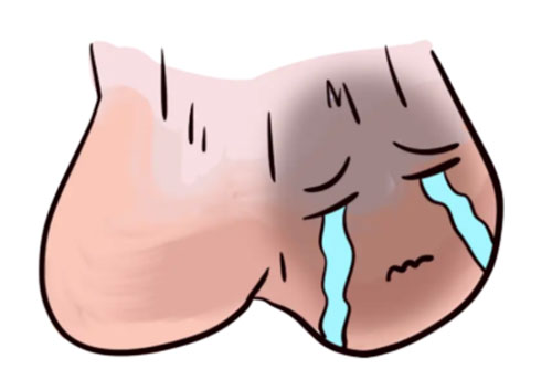 阴囊瘙痒怎么快速止痒