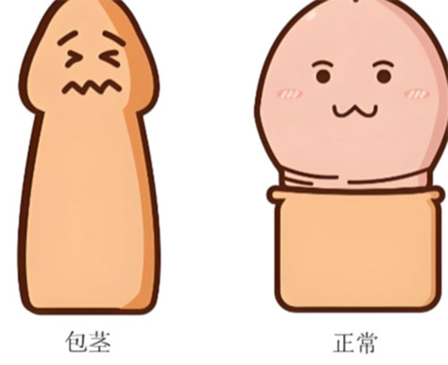 包茎会影响丁丁生长吗