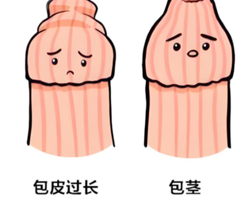 包皮太长有什么危害